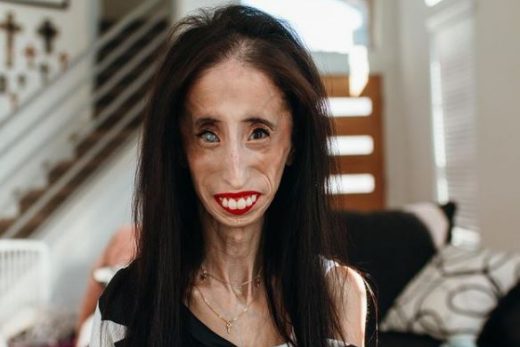Lizzie Velasquez net worth