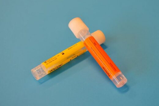 loose-bladder-control in women