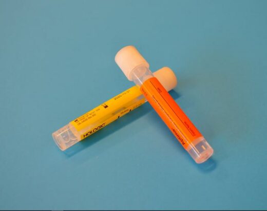 loose-bladder-control in women